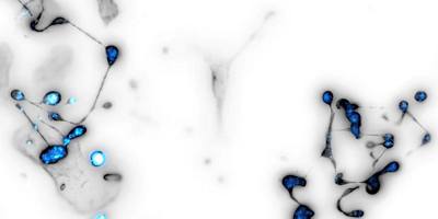 Wound-plugging platelets captured forming inside the bone marrow